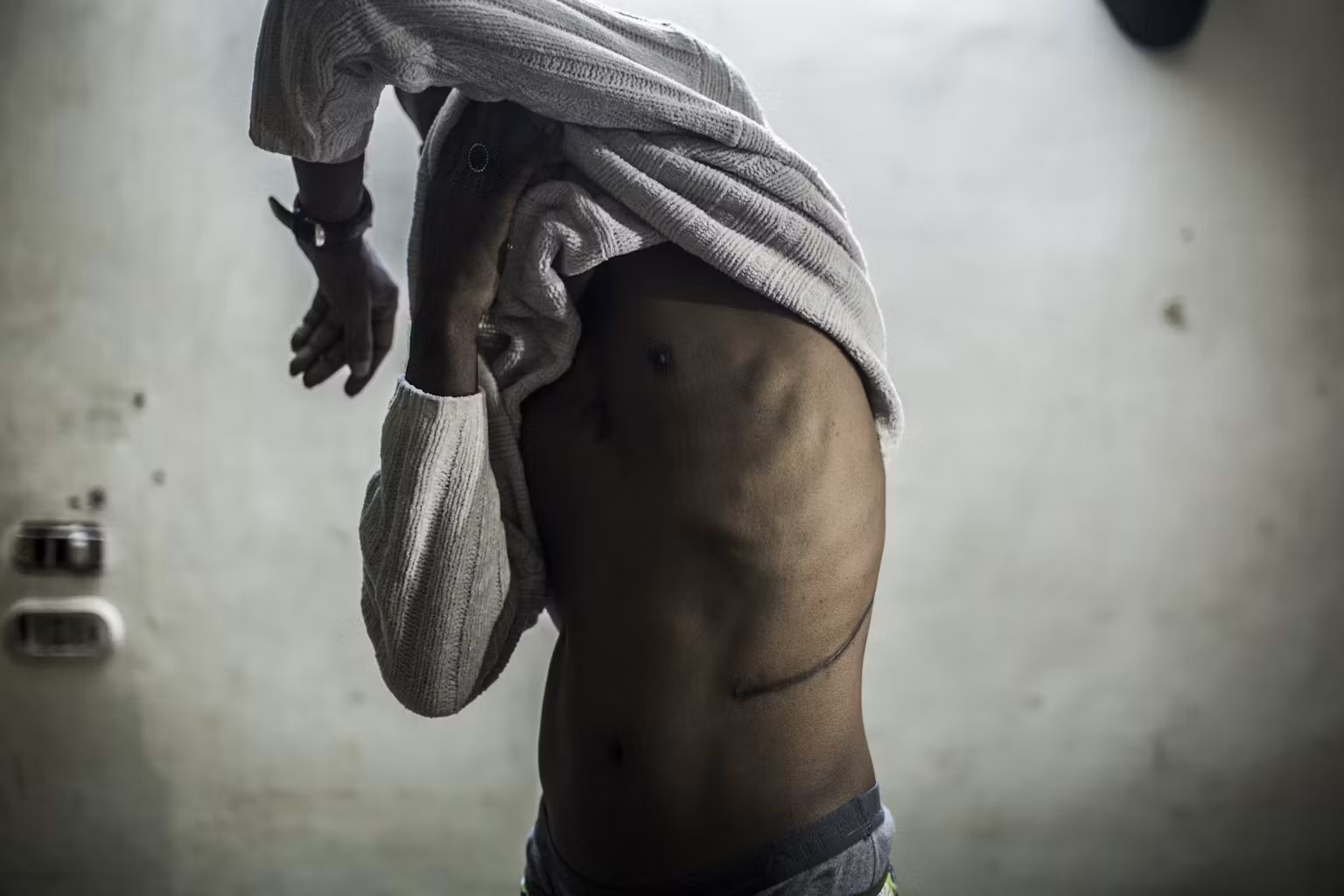 بيع الاعضاء