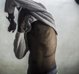 بيع الاعضاء