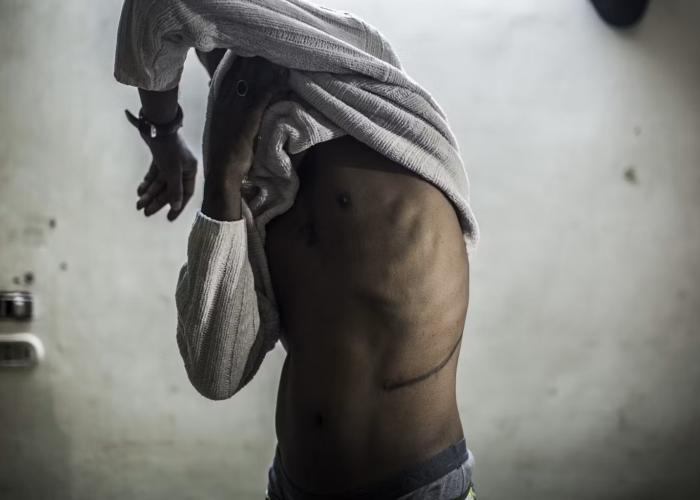 بيع الاعضاء